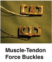 Muscle-tendon force buckles